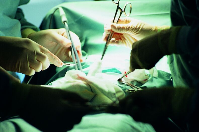 kirurško povečanje debeline penisa